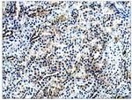 AMACR Polyclonal Antibody