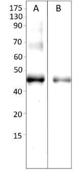 AMACR Polyclonal Antibody