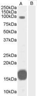 GRAF Antibody in Western Blot (WB)