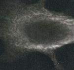 Calreticulin Antibody in Immunocytochemistry (ICC/IF)