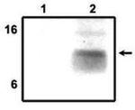 TYROBP Antibody in Western Blot (WB)
