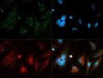 Beclin 1 Antibody in Immunocytochemistry (ICC/IF)