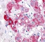 Beclin 1 Antibody in Immunohistochemistry (Paraffin) (IHC (P))