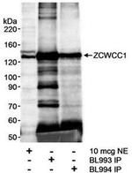 ZCWCC1 Antibody in Western Blot (WB)