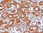 USH1C Polyclonal Antibody
