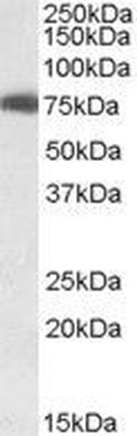 USH1C Antibody in Western Blot (WB)