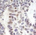 ZNF261 Antibody in Immunohistochemistry (Paraffin) (IHC (P))