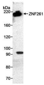 ZNF261 Antibody in Western Blot (WB)