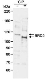 BRD2 Antibody in Western Blot (WB)