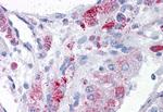 MTA1 Antibody in Immunohistochemistry (Paraffin) (IHC (P))