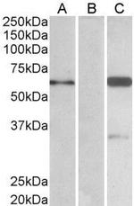 BAI1 Isoform 3 Antibody in Western Blot (WB)