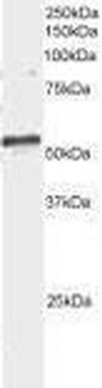 ARFGAP3 Antibody in Western Blot (WB)