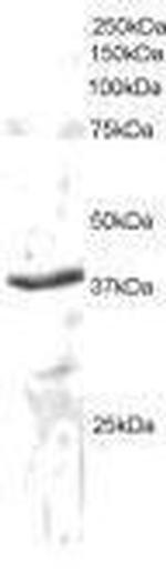 SEC61A1 Antibody in Western Blot (WB)