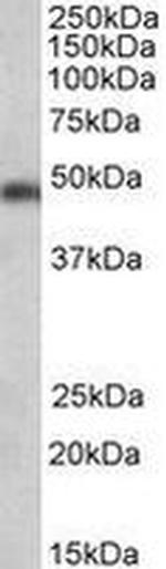 SEC61A1 Antibody in Western Blot (WB)