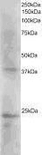 SET Antibody in Western Blot (WB)
