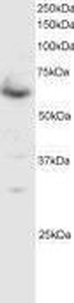 SMAD4 Antibody in Western Blot (WB)