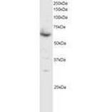 SMAD4 Antibody in Western Blot (WB)