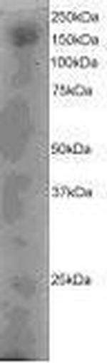 DOCK1 Antibody in Western Blot (WB)