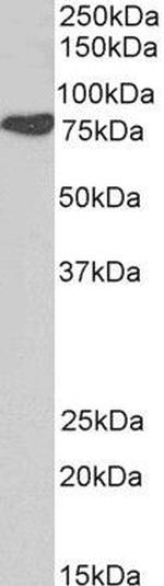 Cortactin Antibody in Western Blot (WB)