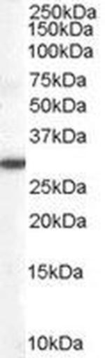 DDAH2 Antibody in Western Blot (WB)
