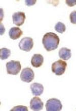 ADAM17 Antibody in Immunocytochemistry (ICC/IF)