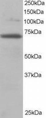 RANGAP1 Antibody in Western Blot (WB)