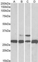 PGAM1 Antibody in Western Blot (WB)