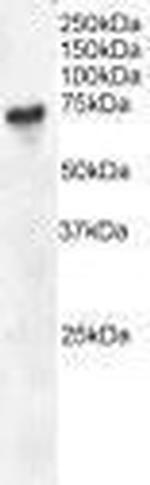 BLNK Antibody in Western Blot (WB)