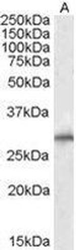 SIAH1 Antibody in Western Blot (WB)