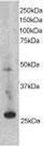 SIAH1 Antibody in Western Blot (WB)