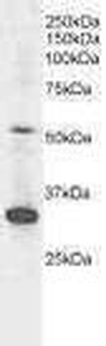 Spinesin Antibody in Western Blot (WB)