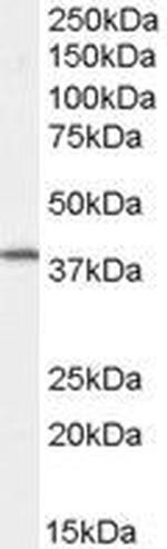 Dysadherin Polyclonal Antibody