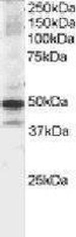 MST4 Antibody in Western Blot (WB)