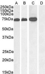 RACGAP1 Antibody in Western Blot (WB)