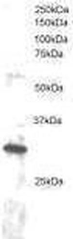 DKK4 Antibody in Western Blot (WB)