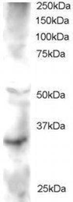 FRAT2 Antibody in Western Blot (WB)