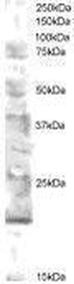 UBE2V2 Antibody in Western Blot (WB)