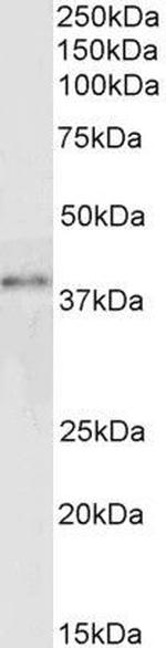 GRAP2 Polyclonal Antibody