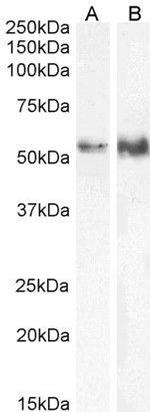 TFEB Antibody in Western Blot (WB)