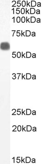 TFEB Antibody in Western Blot (WB)