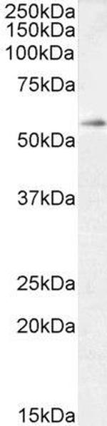 TFEB Antibody in Western Blot (WB)