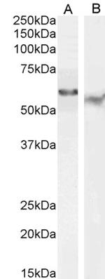 TFEB Antibody in Western Blot (WB)