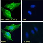 PLK4 Antibody in Immunocytochemistry (ICC/IF)