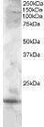 Cystatin F Antibody in Western Blot (WB)