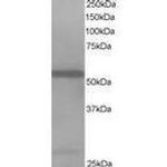 HIP55 Antibody in Western Blot (WB)