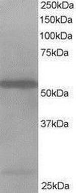 HIP55 Antibody in Western Blot (WB)