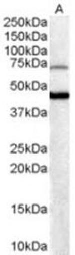 FOXG1 Antibody in Western Blot (WB)