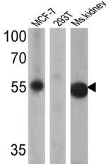 ESRRG Antibody in Western Blot (WB)