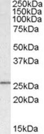SYF2 Antibody in Western Blot (WB)