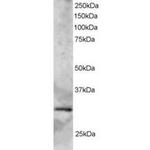 SYF2 Antibody in Western Blot (WB)